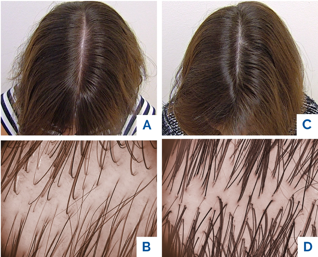 Žena před a po - Tricopat