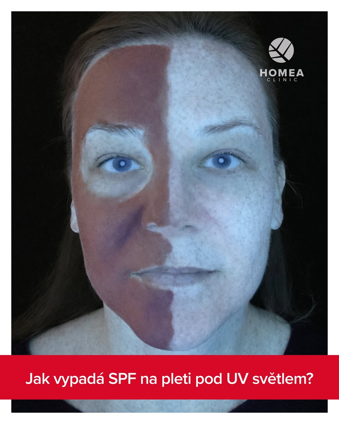 opalování a fotoprotekce